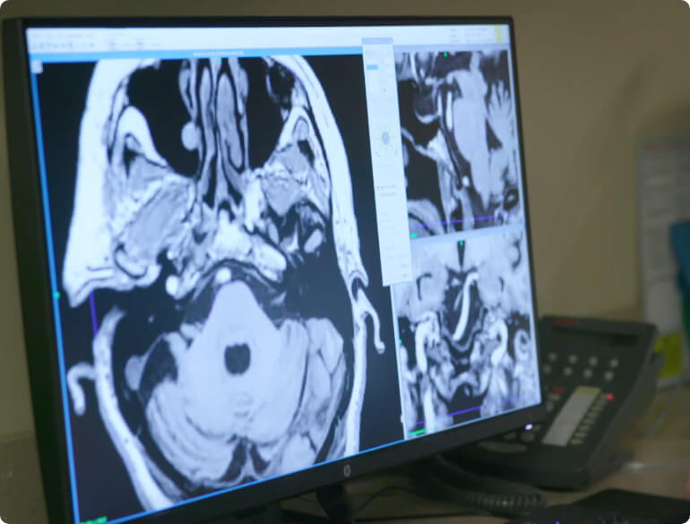Brain imaging for Gamma Knife radiosurgery